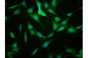 Immunofluorescence staining of NIH/3T3 cells with ABIN7157624 at 1:133, counter-stained with DAPI.