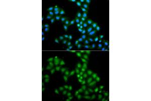 Immunofluorescence analysis of A549 cells using SAMHD1 antibody. (SAMHD1 anticorps  (AA 387-626))