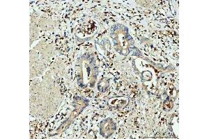 IHC analysis of GPX1 using anti-GPX1 antibody (ABIN3043834). (Glutathione Peroxidase 1 anticorps  (Middle Region))