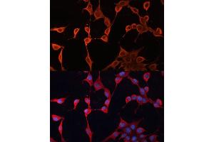 Immunofluorescence analysis of NIH/3T3 cells using DN antibody (ABIN6127811, ABIN6139695, ABIN6139696 and ABIN6222849) at dilution of 1:100.