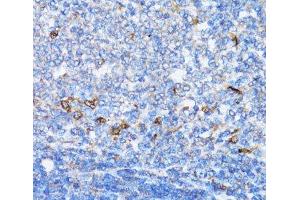 Immunohistochemistry of paraffin-embedded Rat spleen using NDE1 Polyclonal Antibody at dilution of 1:100 (40x lens). (NDE1 anticorps)