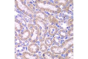 Immunohistochemistry of paraffin-embedded rat kidney using FADD antibody at dilution of 1:200 (400x lens). (FADD anticorps)