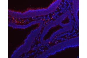 IF analysis of RRS1 using anti-RRS1 antibody (ABIN7602918).