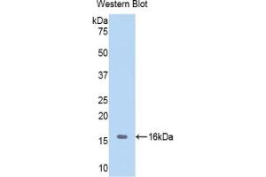 Detection of Recombinant Hemoglobin, Porcine using Polyclonal Antibody to Hemoglobin (HB) (Hemoglobin anticorps)