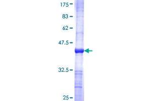 Image no. 1 for Guanylate Cyclase 1, Soluble, alpha 2 (GUCY1A2) (AA 296-401) protein (GST tag) (ABIN1306212)