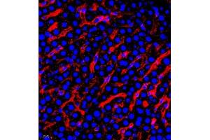 Immunofluorescence of paraffin embedded rat liver using AHSG (ABIN7073021) at dilution of 1:650 (400x lens)