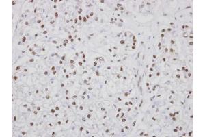 IHC-P Image Immunohistochemical analysis of paraffin-embedded human oral tissue, using PUF60, antibody at 1:100 dilution. (PUF60 anticorps  (C-Term))