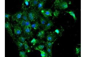 Immunofluorescence (IF) image for anti-NQO2 (NQO2) antibody (ABIN1499816)
