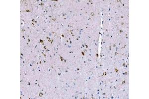 IHC analysis of SCRN1 using anti-SCRN1 antibody (ABIN7602923). (Secernin 1 anticorps  (C-Term))