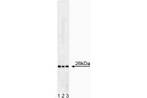 Western blot analysis of Bcl-2. (Bcl-2 anticorps)