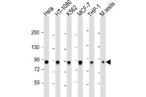 All lanes : Anti-TBK1 Antibody  at 1:2000 dilution Lane 1: Hela whole cell lysate Lane 2: HT-1080 whole cell lysate Lane 3: K562 whole cell lysate Lane 4: MCF-7 whole cell lysate Lane 5: THP-1 whole cell lysate Lane 6: mouse testis lysate Lysates/proteins at 20 μg per lane. (TBK1 anticorps  (AA 150-181))