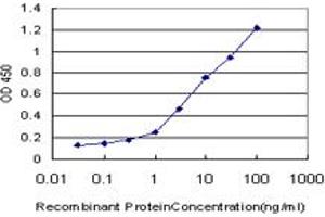 Detection limit for recombinant GST tagged ZIC1 is approximately 0. (ZIC1 anticorps  (AA 2-95))