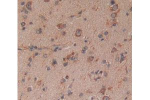 Used in DAB staining on fromalin fixed paraffin- embedded Kidney tissue