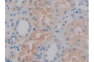 Detection of IL2 in Human Kidney Tissue using Monoclonal Antibody to Interleukin 2 (IL2) (IL-2 anticorps  (AA 21-153))