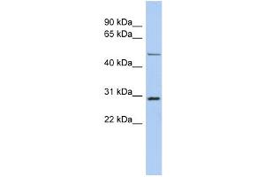 WB Suggested Anti-POU3F3 Antibody Titration:  0. (POU3F3 anticorps  (N-Term))