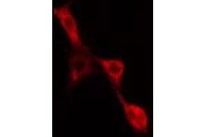 ABIN6277567 staining NIH-3T3 cells by IF/ICC. (EIF4B anticorps  (Internal Region))
