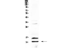 Western blot analysis of PF4 using anti-PF4 antibody . (PF4 anticorps  (AA 30-105))