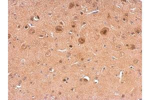 IHC-P Image NCS1 antibody detects NCS1 protein at on mouse fore brain by immunohistochemical analysis.