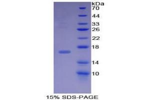 SDS-PAGE analysis of Mouse BMP15 Protein. (BMP15 Protéine)