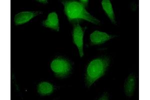 Immunofluorescence of monoclonal antibody to LMNB1 on HeLa cell.