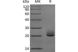 Western Blotting (WB) image for Fibroblast Growth Factor 21 (FGF21) protein (His tag) (ABIN7320901)