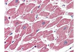 Human Heart (formalin-fixed, paraffin-embedded) stained with CPT1Aat 4 µg/ml followed by biotinylated anti-goat IgG secondary antibody, alkaline phosphatase-streptavidin and chromogen. (CPT1A anticorps  (Internal Region))