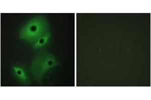 Immunofluorescence (IF) image for anti-Neuroblastoma 1, DAN Family BMP Antagonist (NBL1) (AA 131-180) antibody (ABIN2889475)