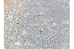 ABIN6262555 and ABIN6276764 at 1/100 staining human normal tonsil tissue by IHC-P. (IL23R anticorps  (N-Term))