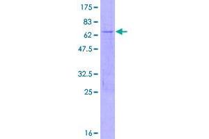 Image no. 1 for Methyl-CpG Binding Domain Protein 3 (MBD3) (AA 1-291) protein (GST tag) (ABIN1310465)