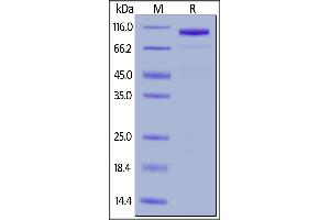 Human LRP-5, Mouse IgG2a Fc Tag on  under reducing (R) condition. (LRP5 Protein (AA 644-1263) (Fc Tag))