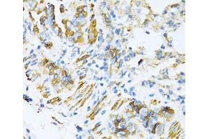 Immunohistochemistry of paraffin-embedded Mouse lung using VAMP1 Polyclonal Antibody at dilution of 1:100 (40x lens). (VAMP1 anticorps)