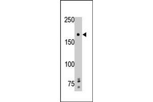 The PTPRG polyclonal antibody  is used in Western blot to detect PTPRG in mouse brain tissue lysate.