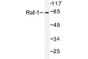 Image no. 1 for anti-V-Raf-1 Murine Leukemia Viral Oncogene Homolog 1 (RAF1) antibody (ABIN271798) (RAF1 anticorps)