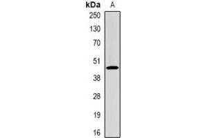 Western blot analysis of CFHR1 expression in mouse liver (A) whole cell lysates. (CFHR1 anticorps)