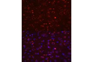Immunofluorescence analysis of rat brain using STAT3 antibody.
