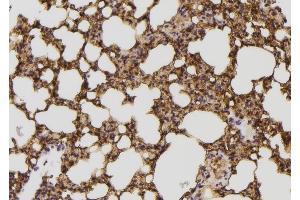 ABIN6257902 and ABIN6274337 at 1/100 staining Mouse lung tissue by IHC-P. (IB2 anticorps  (Internal Region))