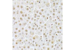 Immunohistochemistry of paraffin-embedded rat liver using CDK4 Antibody.