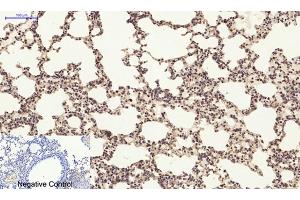 Immunohistochemical analysis of paraffin-embedded mouse lung tissue. (PI3K p85 alpha/gamma anticorps)