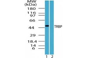 Image no. 3 for anti-TAR (HIV-1) RNA Binding Protein 2 (TARBP2) (AA 340-390) antibody (ABIN207742) (TARBP2 anticorps  (AA 340-390))