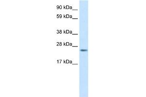 WB Suggested Anti-FADD Antibody Titration:  0. (FADD anticorps  (C-Term))