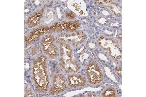 Immunohistochemical staining of human kidney with PTS polyclonal antibody  shows cytoplasmic and membranous positivity in cells of renal tubules at 1:50-1:200 dilution.