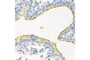 Immunohistochemistry of paraffin-embedded mouse lung using STRN3 antibody at dilution of 1:100 (x40 lens). (STRN3 anticorps)