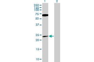 Western Blot analysis of PPP1CB expression in transfected 293T cell line by PPP1CB MaxPab polyclonal antibody. (PPP1CB anticorps  (AA 1-327))