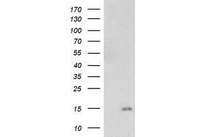 Western Blotting (WB) image for anti-NADH Dehydrogenase (Ubiquinone) 1 alpha Subcomplex, 7, 14.5kDa (NDUFA7) antibody (ABIN1499657)