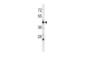 Western blot analysis in mouse spleen tissue lysates (35ug/lane).