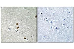 Immunohistochemical analysis of paraffin-embedded human brain tissue, using CtBP1 (Phospho-Ser422) antibody (left)or the same antibody preincubated with blocking peptide (right). (CTBP1 anticorps  (pSer422))