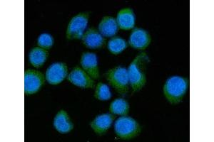 IF analysis of MLX-interacting protein/MLXIP using anti-MLX-interacting protein/MLXIP antibody (ABIN7602593).