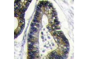 Image no. 1 for anti-Finkel-Biskis-Reilly Murine Sarcoma Virus (FBR-MuSV) Ubiquitously Expressed (FAU) (N-Term) antibody (ABIN357135)