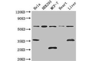 Western Blot Positive WB detected in: Hela whole cell lysate, HEK293 whole cell lysate, MCF-7 whole cell lysate, Mouse heart tissue, Mouse liver tissue All lanes: NCOA5 antibody at 3 μg/mL Secondary Goat polyclonal to rabbit IgG at 1/50000 dilution Predicted band size: 66 kDa Observed band size: 66, 35, 25 kDa (NCOA5 anticorps  (AA 112-283))