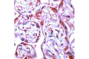 Immunohistochemical staining of human placenta stained with MMP1 polyclonal antibody  at 1 : 100 for 10 min at RT. (MMP1 anticorps  (C-Term))